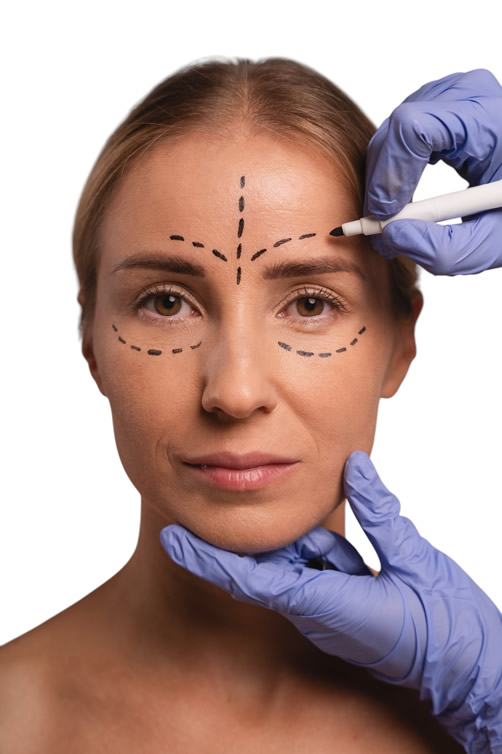 Blefaroplastia